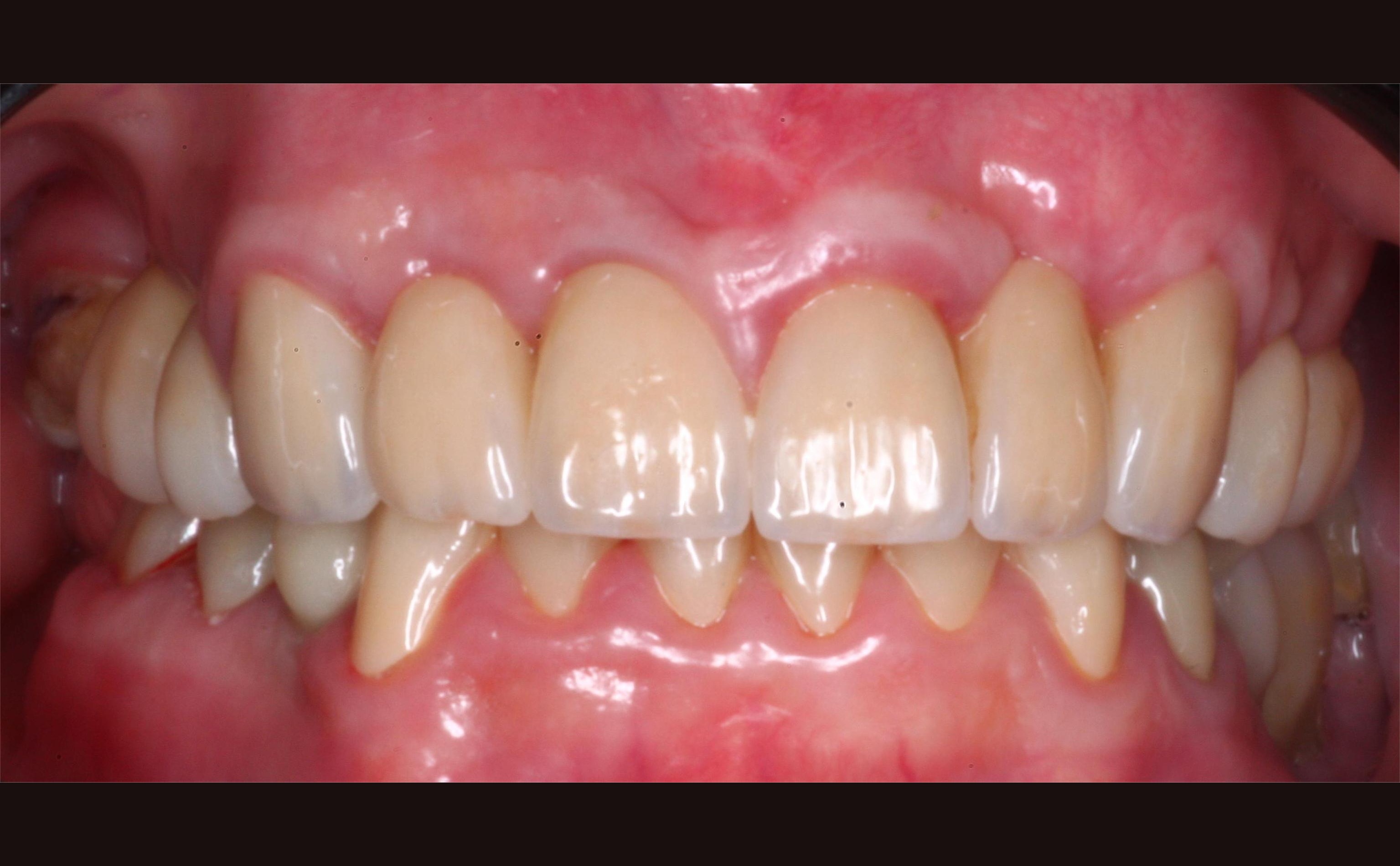 Después
